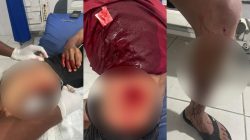 Polda Sulteng Jamin Proses Hukum Objektif Konflik Utang Berakhir Penikaman